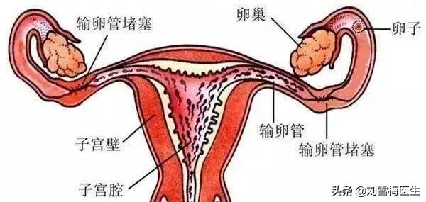 宫外孕后再备孕要注意什么,宫外孕手术后如何避免再次宫外孕