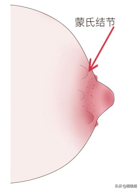 孕期乳房二次发育如何保养,孕期乳房怎么处理干净