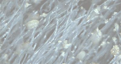 裸睡被子喷完除螨虫剂可以不洗吗,有螨虫的床裸睡会有什么危害