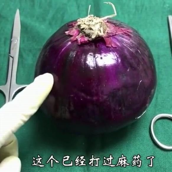 产科医生剖腹产真实流程,妇产科医生剖腹产片段