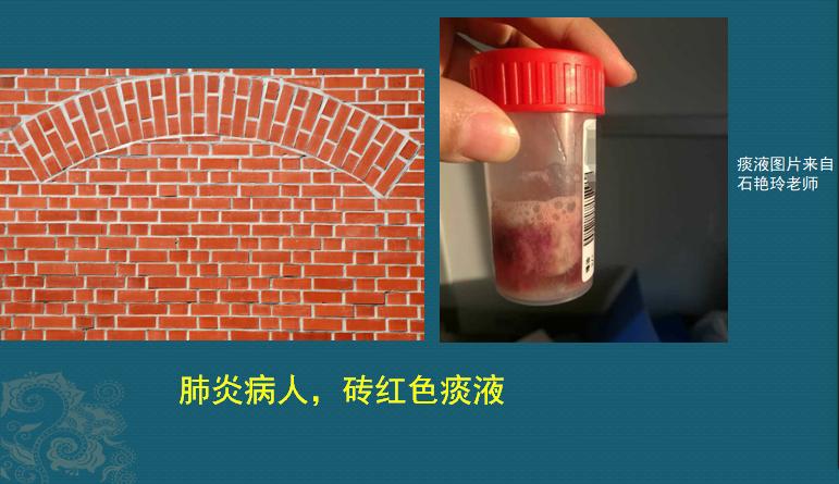 肺炎感染者吐痰,肺炎患者咳大量黄痰最有可能感染