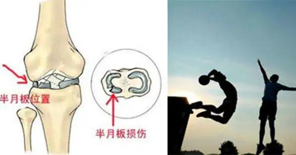 膝盖走路老是打弯是缺钙么,走路膝盖咯噔咯噔响是缺钙吗