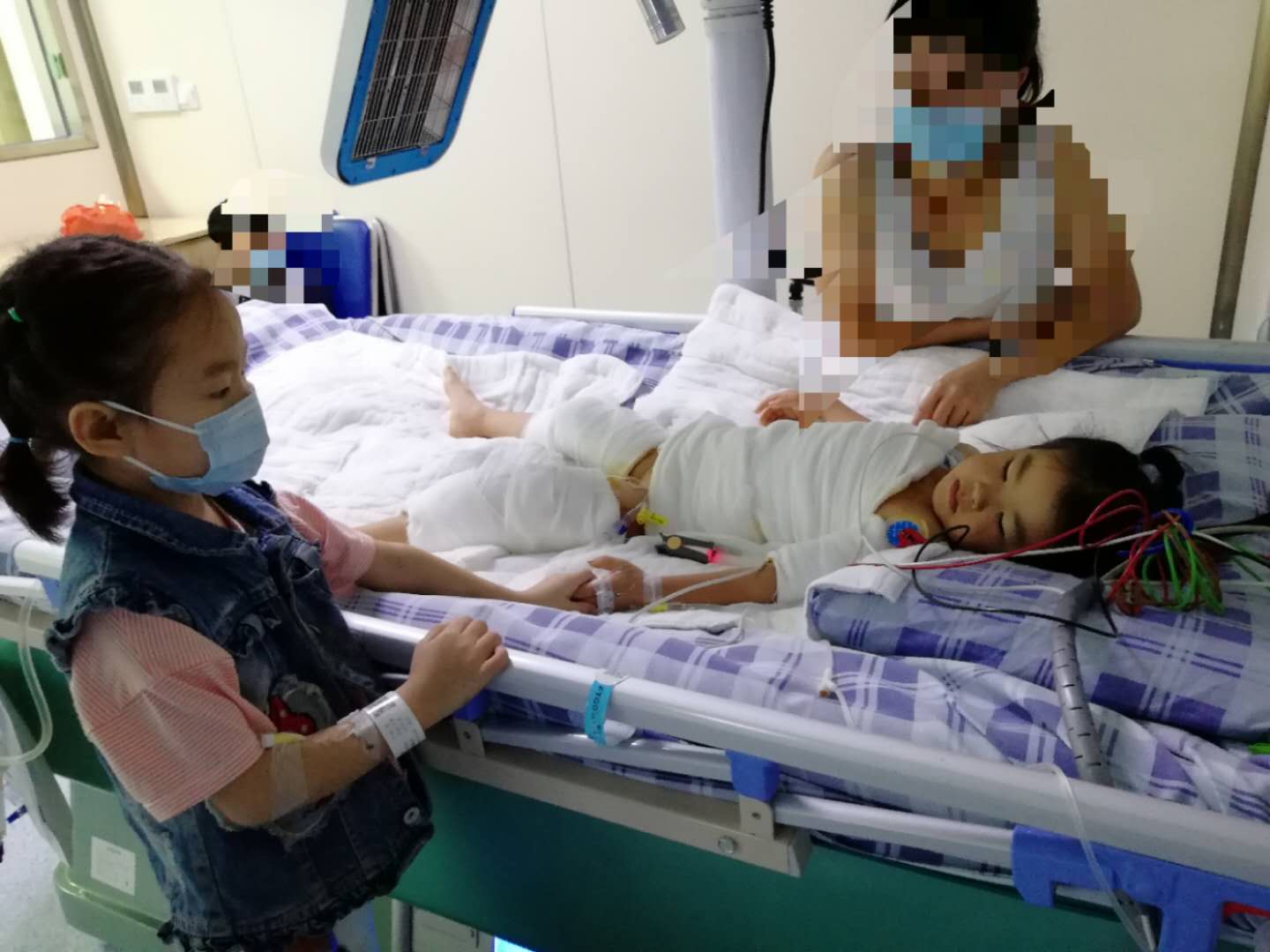 全身烫伤的那些人现在过得怎么样,烫伤女孩恢复过程