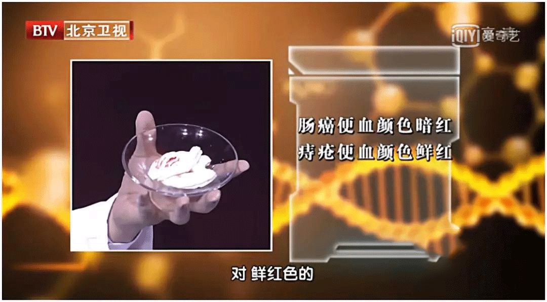 肠癌出现症状往往就是晚期吗,为什么肠癌一发现就是晚期