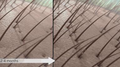 澳洲茶树精油洗发水去头屑,头发一摸全是油