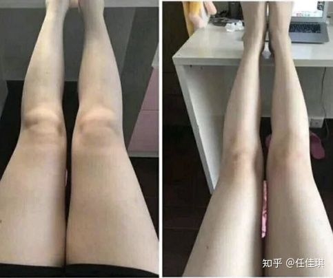 肌肉腿最简单的瘦腿方法,肌肉腿的正确瘦腿方法