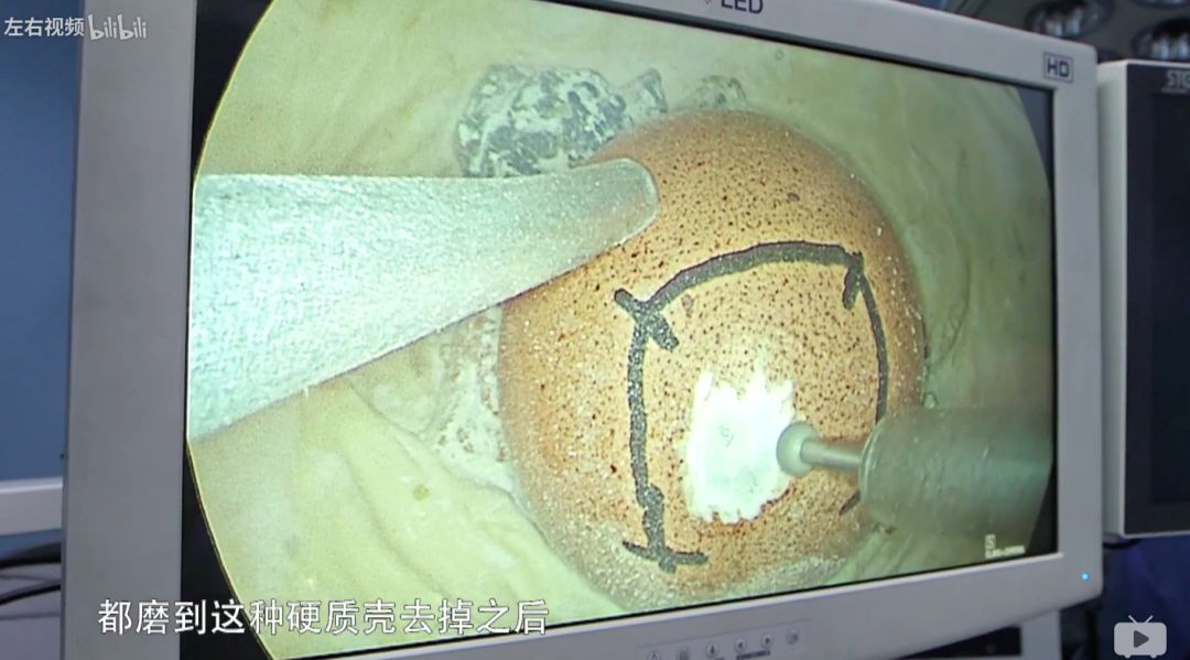 关于医疗纪录片推荐,不煽情却感人