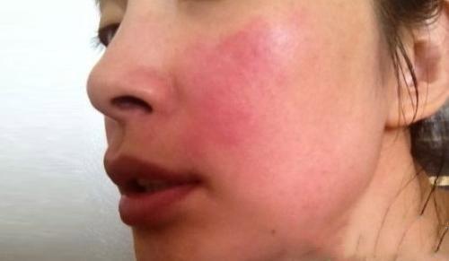 白醋盐洗脸的正确美白方法,白醋洗脸的正确方法美白