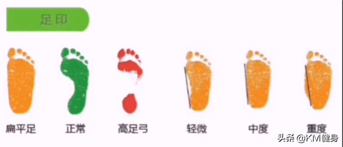 扁平足对运动有什么影响,扁平足适合什么运动项目