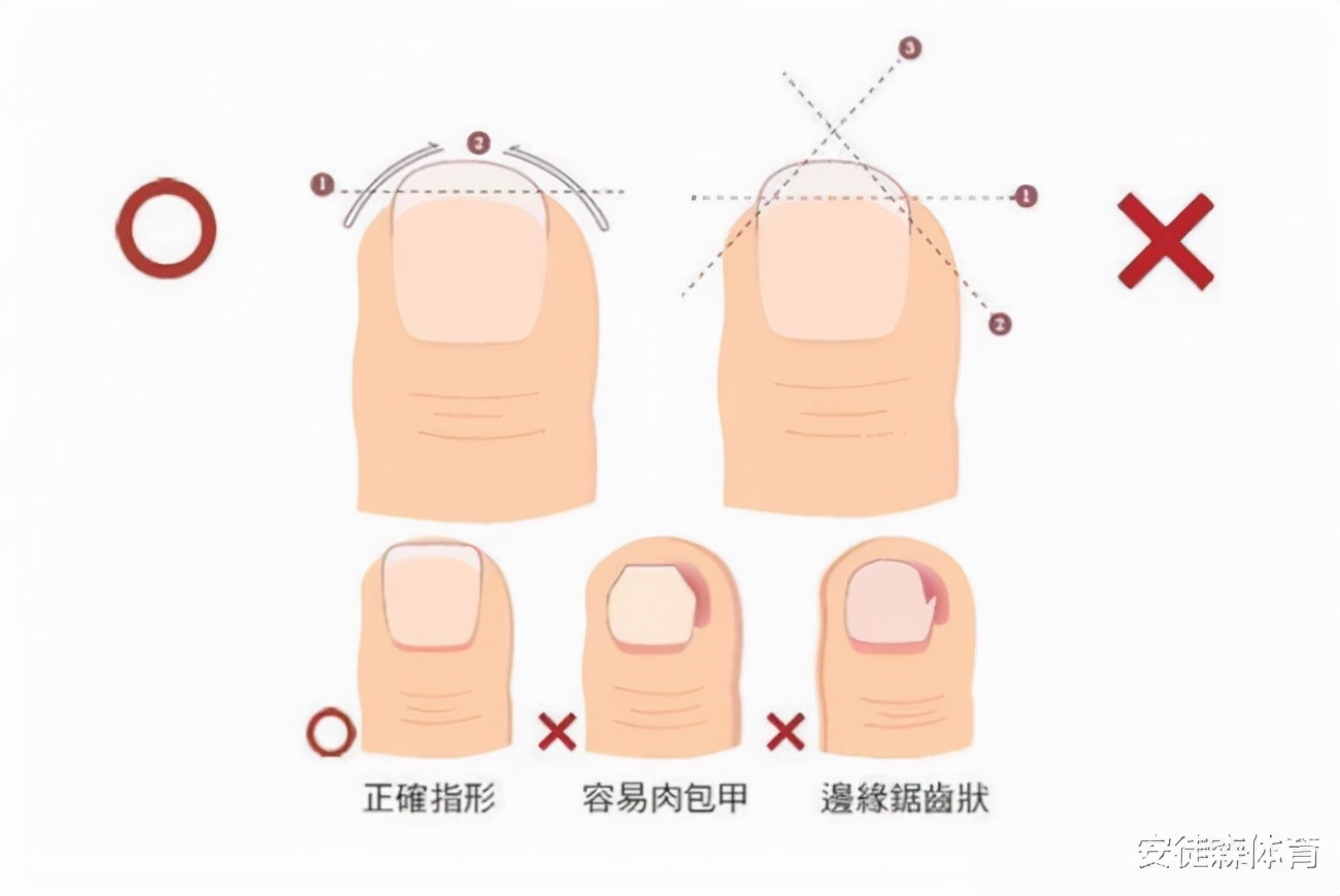 跑步时如何保护指甲,跑步脚趾甲怎么修剪