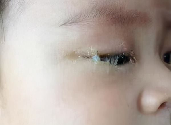 奶奶用土方法治病,奶奶用土方法给孙子治病