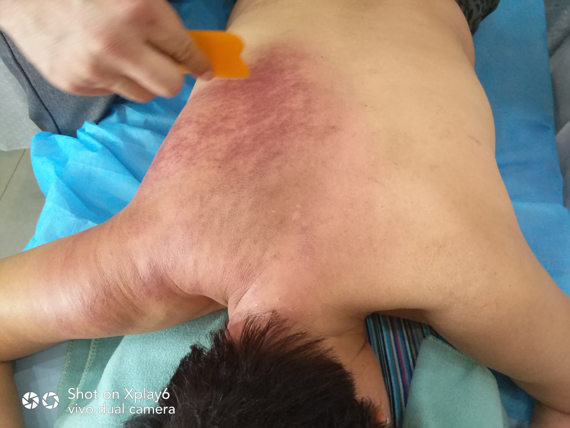 中医养生美容店设备,美容养生店好做吗