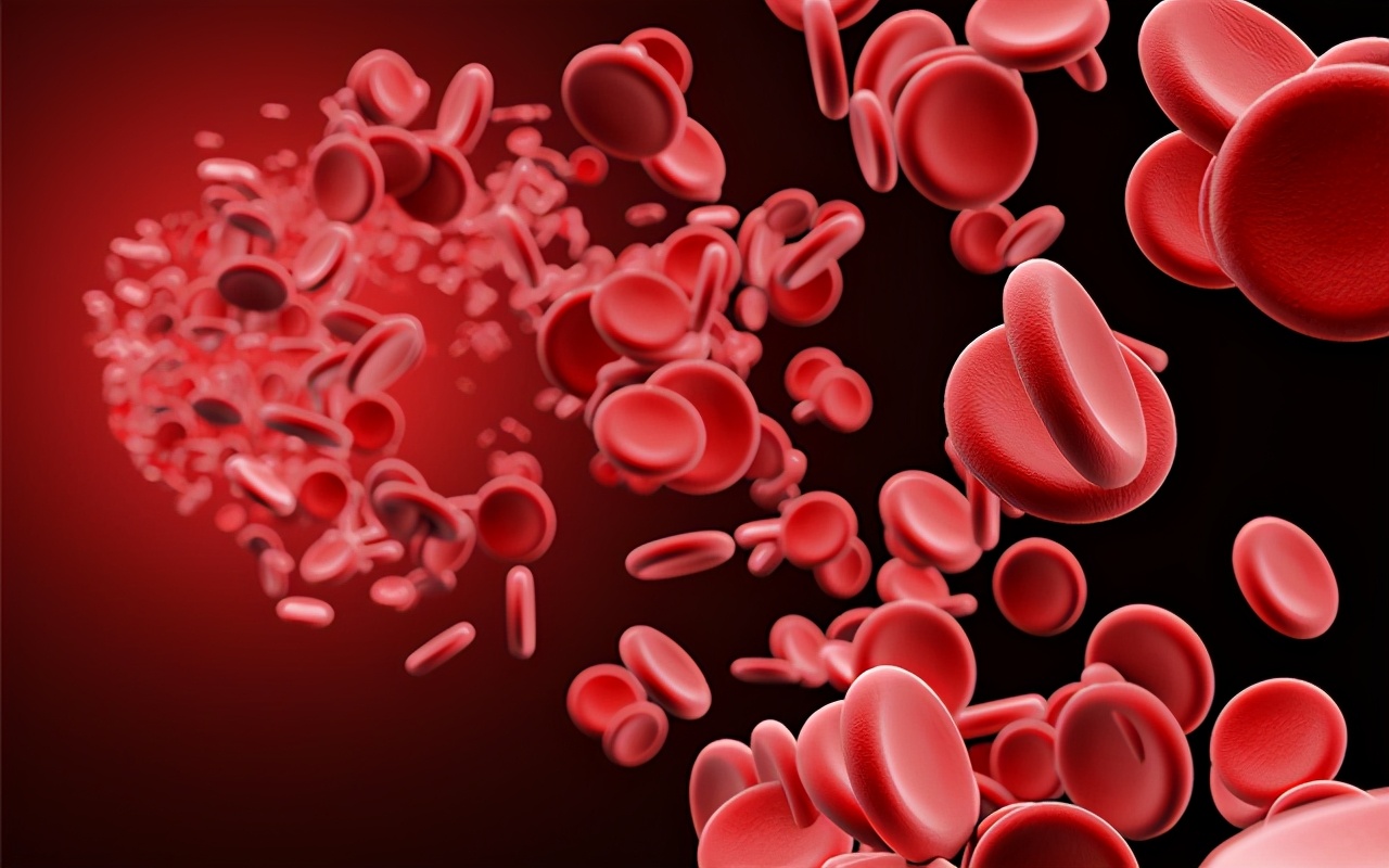 过敏性紫癜夏天血管变脆吗,血管紫癜是什么原因引起的