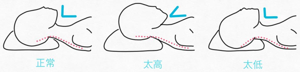 睡醒脖子痛一招搞定,睡醒脖子累怎么缓解