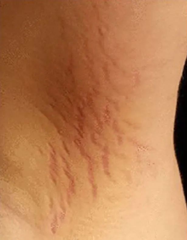 十六岁的男孩精神分裂症的前兆,14岁精神分裂症妄想症有哪些表现