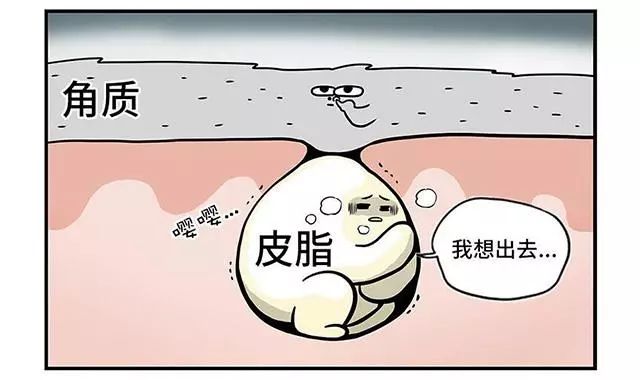 后背长闭合性粉刺怎么办,下巴长闭合性粉刺怎么去除