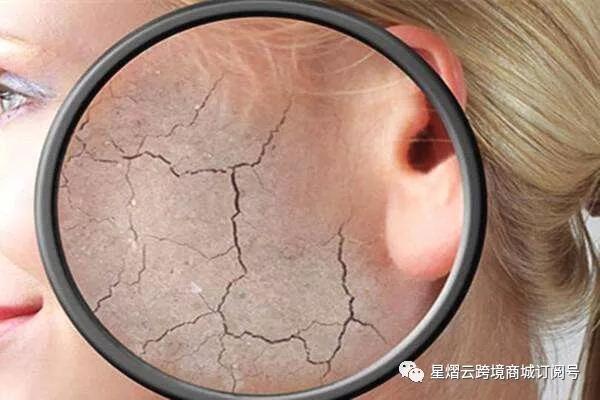 皮肤干燥怎么办吃什么药最好,皮肤干燥怎么办才能改善