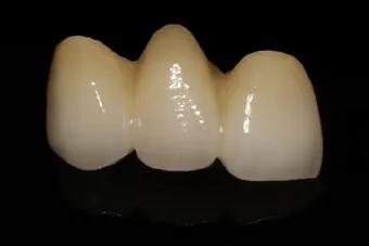 我才20岁为什么牙齿会碎掉,27岁缺牙不补有什么坏处