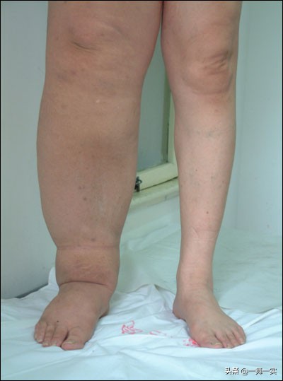 每天坚持踮脚靠墙站10分钟会瘦吗,每天双腿靠墙倒一个小时的效果