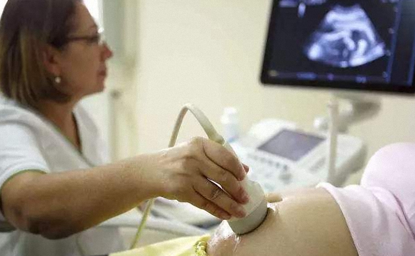 顺产的7个弊端,不是每一个人都适合顺产,孕妈对比一下