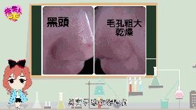 脸上毛孔里挤出来个小痘痘,脸上毛孔大挤出来都是白的