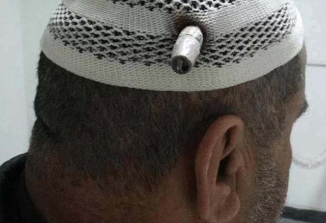 头部中弹为什么没反应,头部被子弹击中能不能抢救