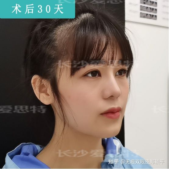 做个双眼皮就能变美,怎么贴双眼皮的时候更自然更好看