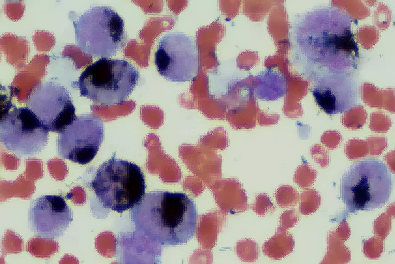 粒单不决问组化?有时还真不一定...