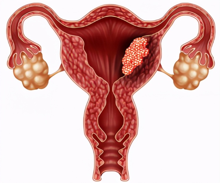 默沙东靶向药有哪些,默沙东非小细胞肺癌靶向治疗药物