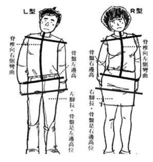 久坐跷二郎腿会使屁股变大么,跷二郎腿正在毁掉你3招帮你纠正
