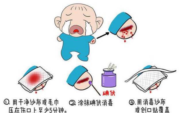 宝宝磕着头破皮了怎么办,宝宝磕到的地方破皮了怎么办