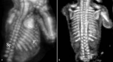 做彩超四维正常胎儿无畸形吗,胎儿脊柱超声几周做