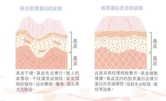 牙科半导体激光美白效果怎么样,激光美白牙齿和冷光美白哪个好