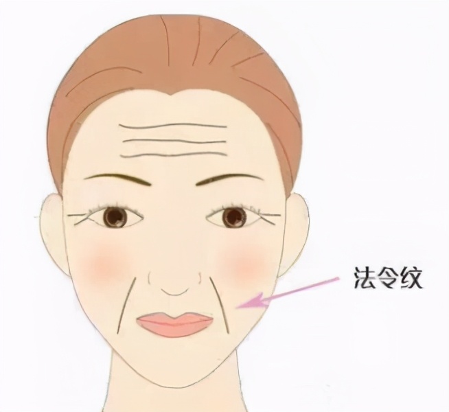 法令纹是什么怎么改善,为什么会有法令纹怎样才能消除