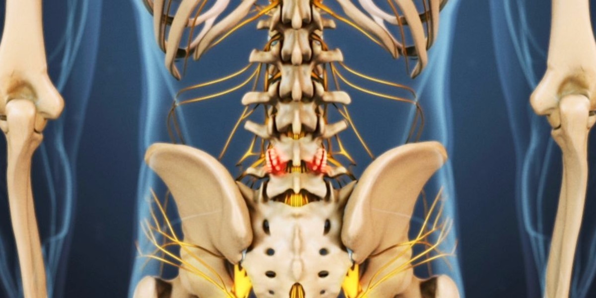 运动后致腰部疼痛怎么缓解,运动后腰部酸疼怎么缓解中老年