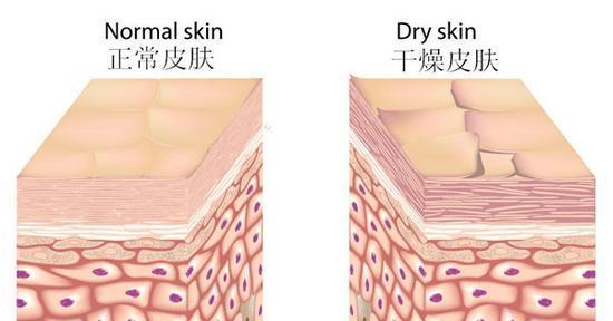 洗澡时搓下来的泥是什么？在显微镜下放大一百倍，看后让人不舒服