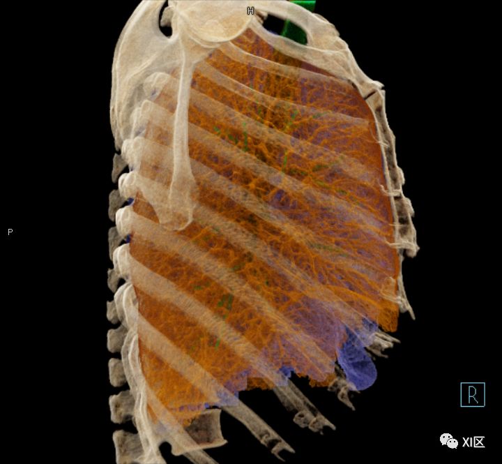 如此详细的肺部影像解剖，有点儿酷！
