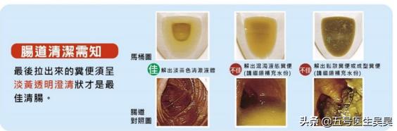 肠道长了息肉怎么办,肠道里的息肉需要处理吗