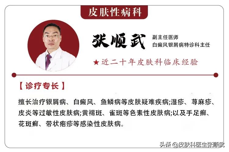 银屑病怎么治疗才好得快,看中医调理银屑病