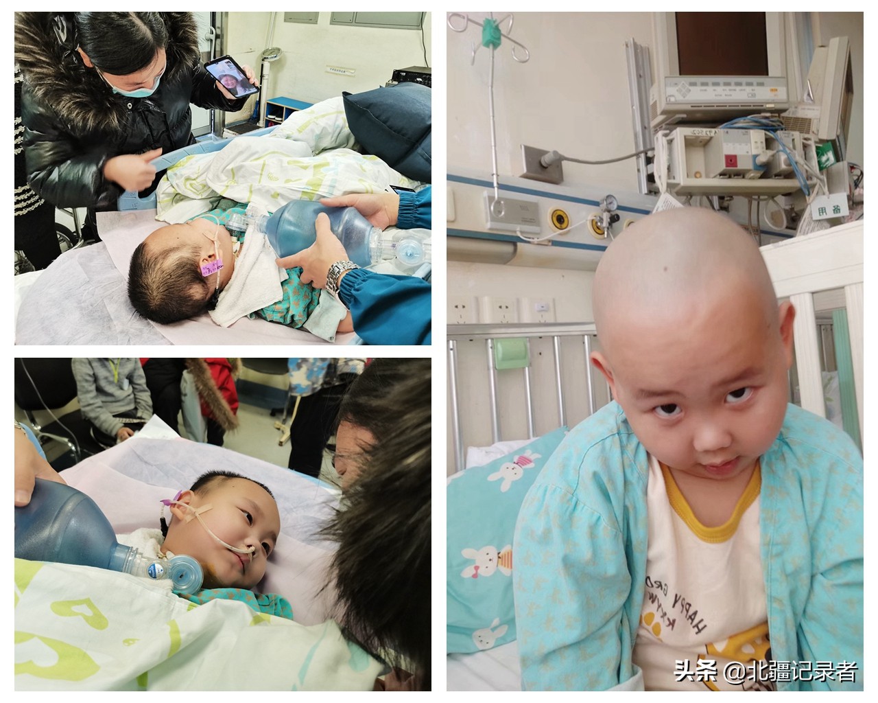 小孩咳嗽厉害突然死亡,孩子因为支气管肺炎住院的视频