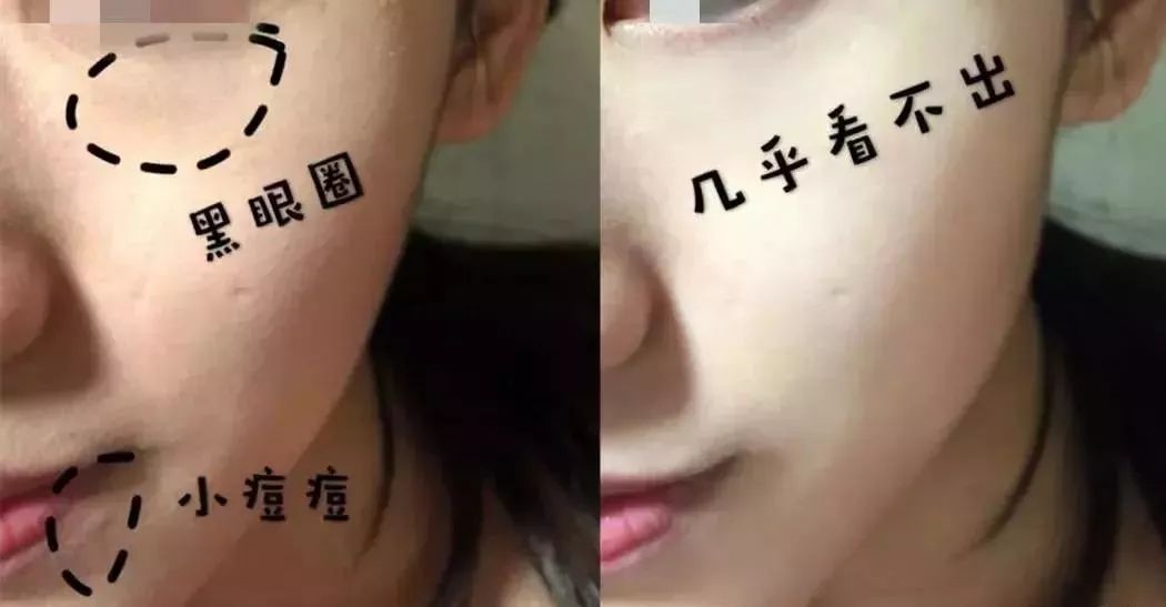 古力娜扎呼吸气垫,古力娜扎的气垫