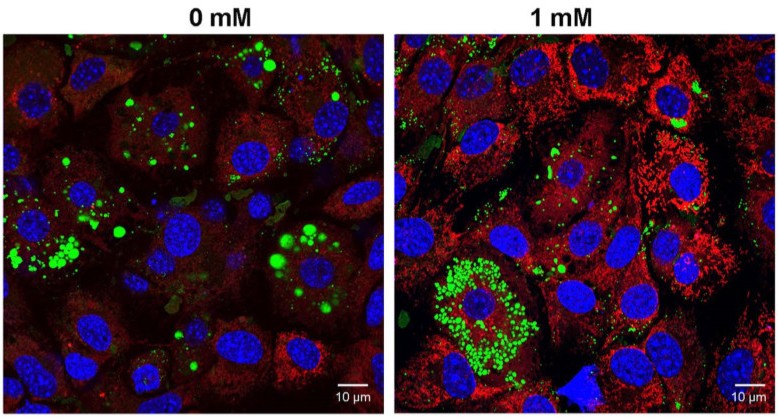 为什么喝咖啡很亢奋,喝咖啡变得特别兴奋