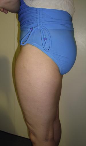 股内侧肌怎么拉伸放松,股外侧肌紧张怎么缓解