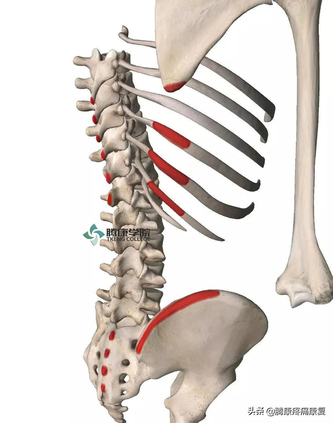 背阔肌综合征病历,背阔综合症
