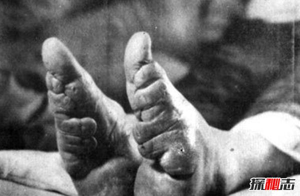 真实的三寸金莲真的好看吗,三寸金莲真的美吗