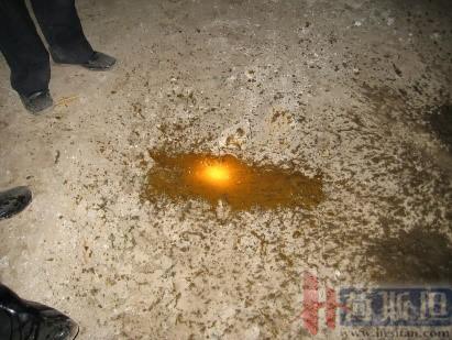 产后急性子宫内膜炎,产后急性宫颈炎症状