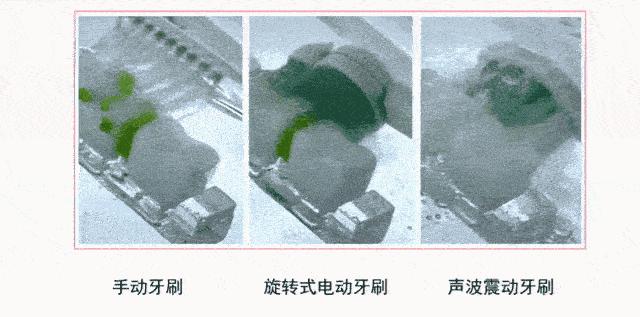 牙黄最有效变白方法,女性牙黄最有效的方法