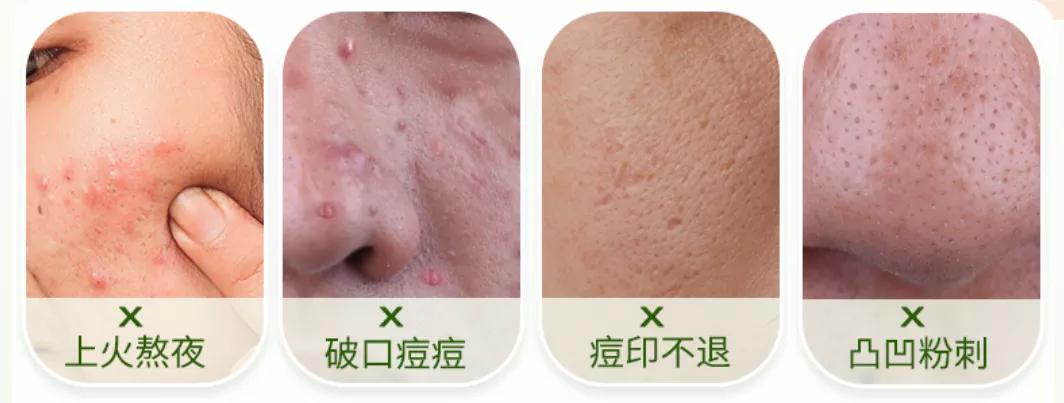 专为男士护肤洗面奶,专为男士除螨洗面奶