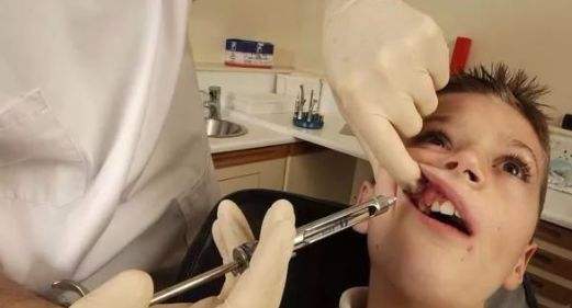 宝宝拔牙妈妈自责,为什么小孩拔牙打麻药还是痛