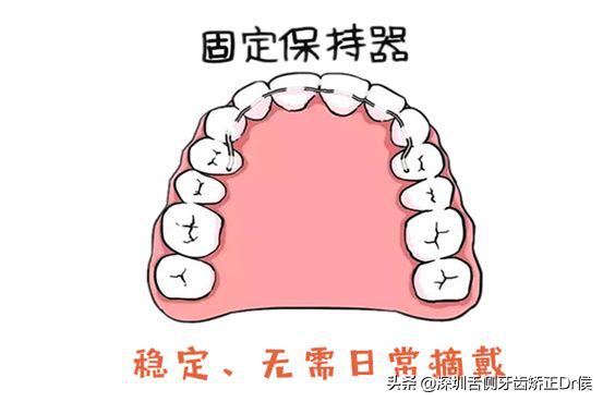 保持器怎么做微调,保持器该怎么选